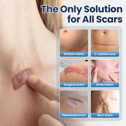 𝑶𝒇𝒇𝒊𝒄𝒊𝒂𝒍 𝑺𝒕𝒐𝒓𝒆 | LBMLBM® Texture Repair Gel — Say Goodbye to Stubborn Scars & Uneven Texture in 4 Weeks