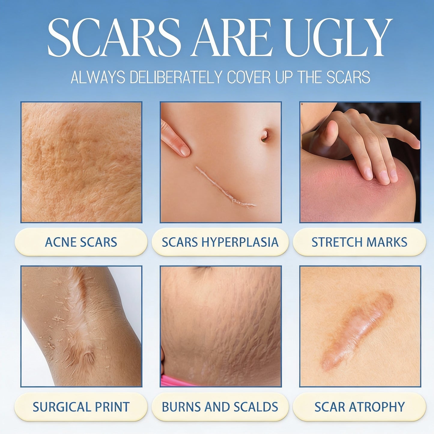 ❤️50% OFF Sale🔥𝑶𝒇𝒇𝒊𝒄𝒊𝒂𝒍 𝑺𝒕𝒐𝒓𝒆 | LBMLBM® Scar Removal Cream — Restore Skin & Regain Confidence🌹