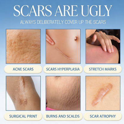 ❤️50% OFF Sale🔥𝑶𝒇𝒇𝒊𝒄𝒊𝒂𝒍 𝑺𝒕𝒐𝒓𝒆 | LBMLBM® Scar Removal Cream — Restore Skin & Regain Confidence🌹