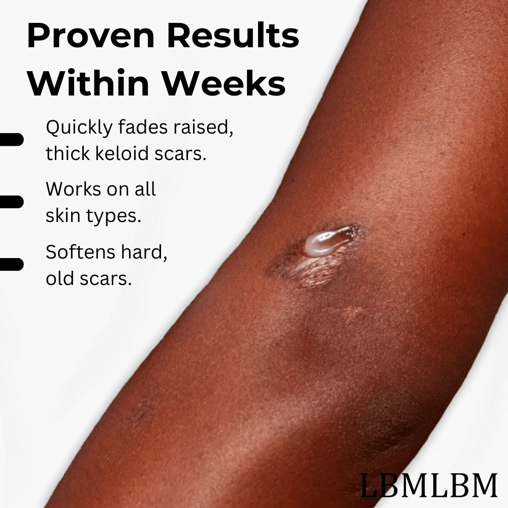 💥50% OFF💥LBMLBM™ Medical-Grade Silicone Scar Gel