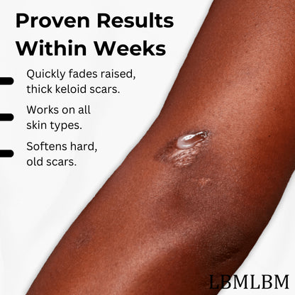 💥50% OFF💥LBMLBM™ Medical-Grade Silicone Scar Gel