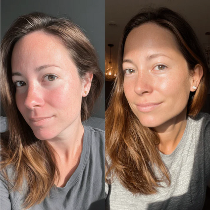 💥50% OFF💥LBMLBM® Natural Moisturizer Hydrates Balm