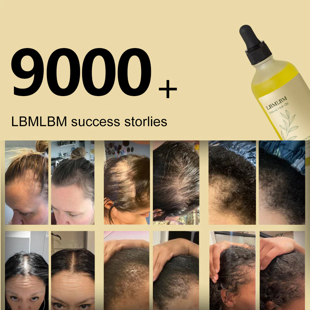 𝑶𝒇𝒇𝒊𝒄𝒊𝒂𝒍 𝑺𝒕𝒐𝒓𝒆 | LBMLBM® Ultra-Fast Growth Oil for Thinning Hair