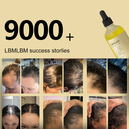 𝑶𝒇𝒇𝒊𝒄𝒊𝒂𝒍 𝑺𝒕𝒐𝒓𝒆 | LBMLBM® Ultra-Fast Growth Oil for Thinning Hair