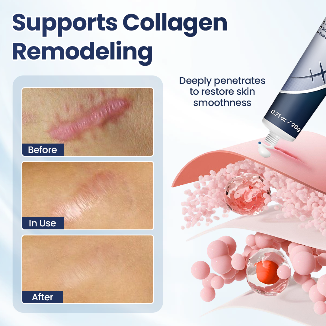 𝑶𝒇𝒇𝒊𝒄𝒊𝒂𝒍 𝑺𝒕𝒐𝒓𝒆 | LBMLBM® Texture Repair Gel — Say Goodbye to Stubborn Scars & Uneven Texture in 4 Weeks