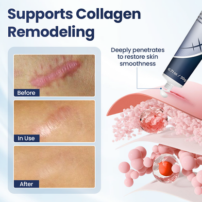 𝑶𝒇𝒇𝒊𝒄𝒊𝒂𝒍 𝑺𝒕𝒐𝒓𝒆 | LBMLBM® Texture Repair Gel — Say Goodbye to Stubborn Scars & Uneven Texture in 4 Weeks