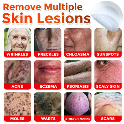 👩‍⚕️𝑶𝒇𝒇𝒊𝒄𝒊𝒂𝒍 𝑺𝒕𝒐𝒓𝒆 | ODALIT™ Gentle Microneedle Patches for Skin Tag & Mole Removal